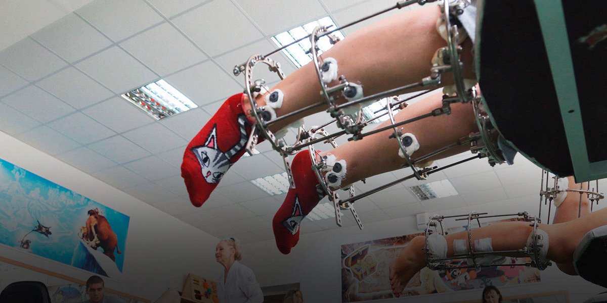 «Красота требует жертв»: как россиянки ломают себе пальцы ради идеальной стопы «Красота требует жертв»: как россиянки ломают себе пальцы ради идеальной стопы